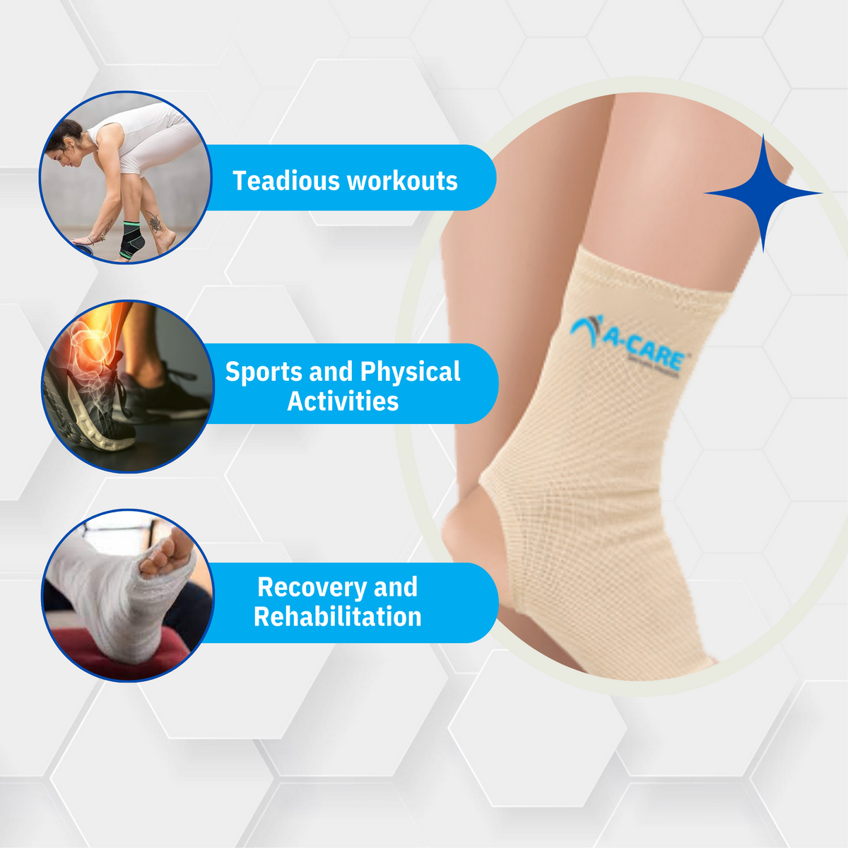 Acare Anklet (Delux) - Surgismart