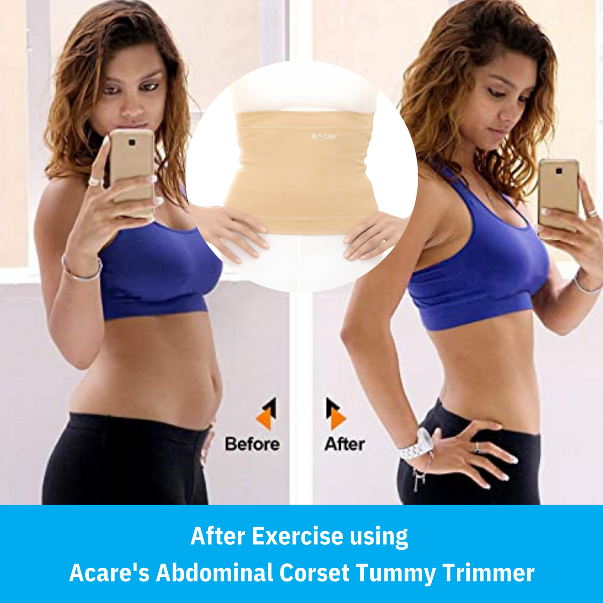 Acare Abdominal Corset (Tummy slimmer)
