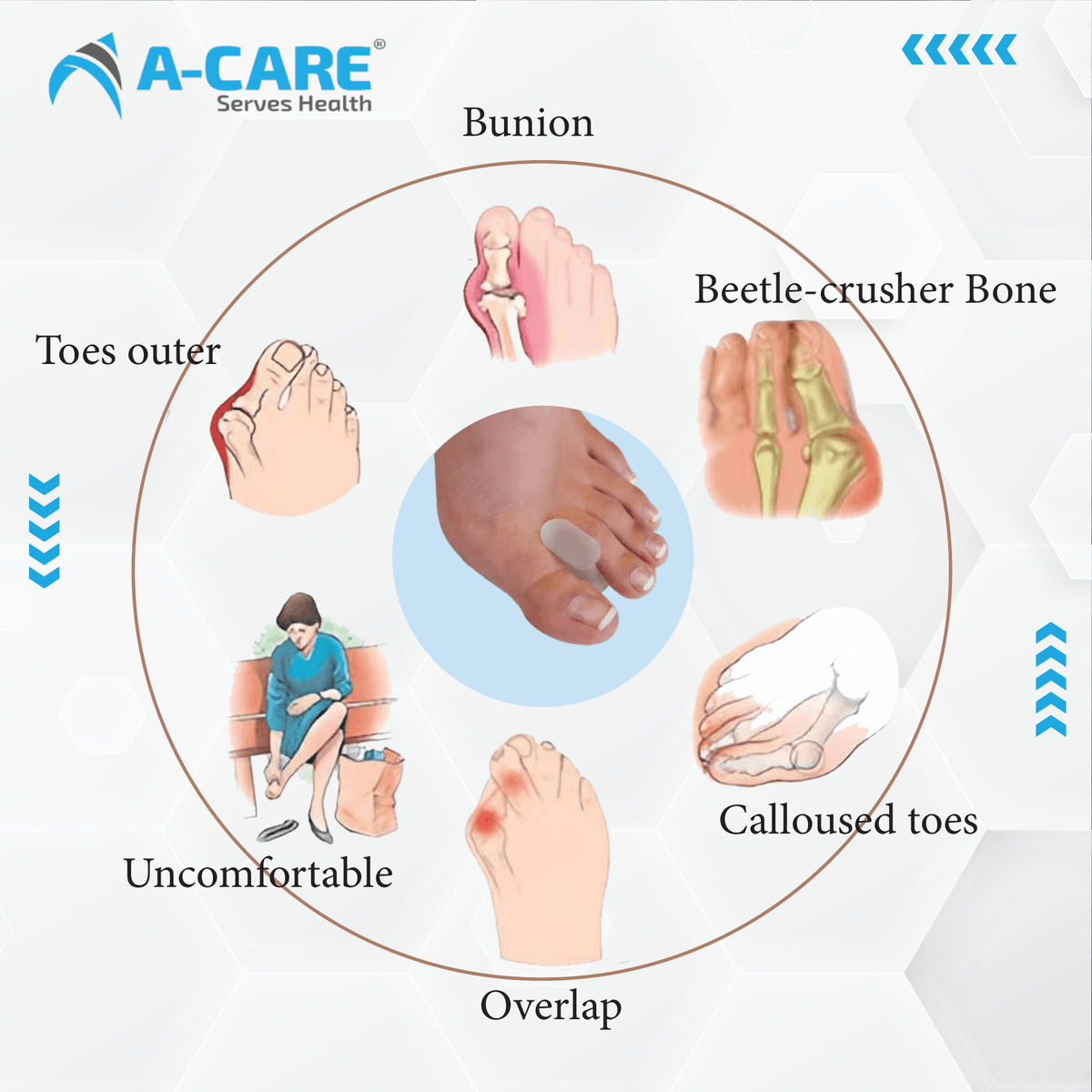Acare SILICON TOE-SEPERATED