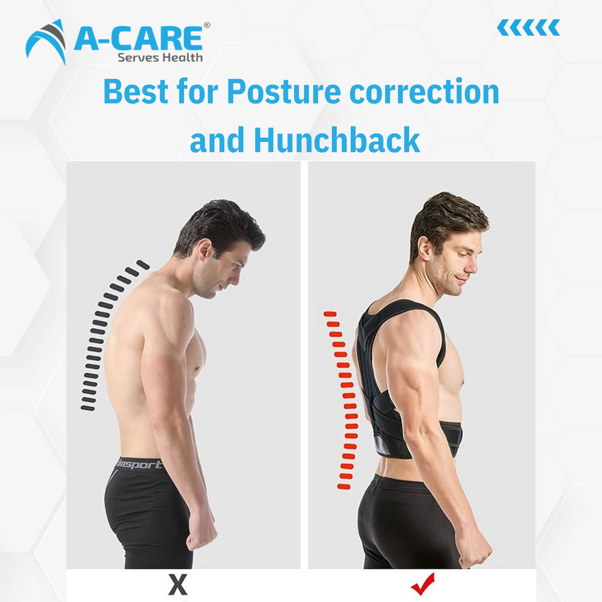 Acare Taylor's Brace - Surgismart